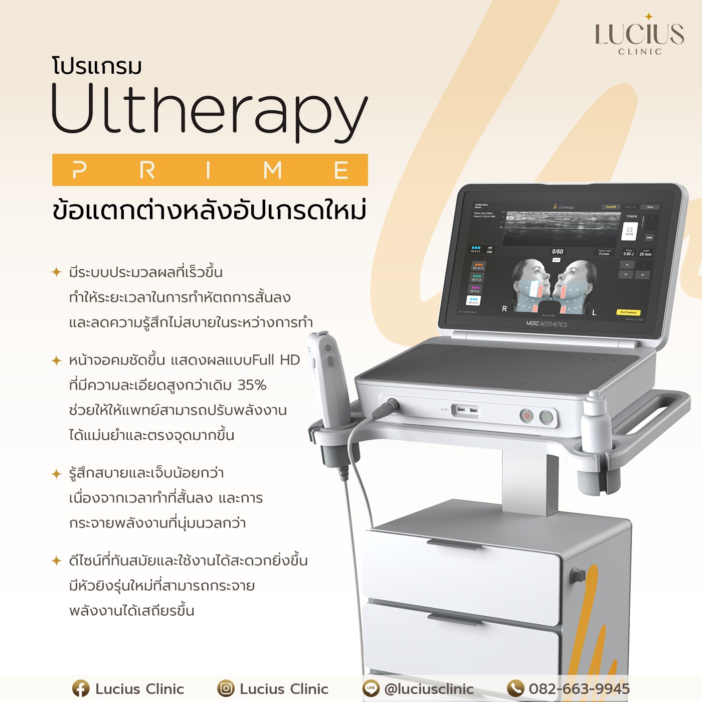 Ulthera Prime Upgrade